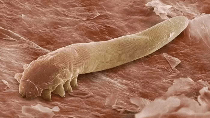 Parasites in the human body