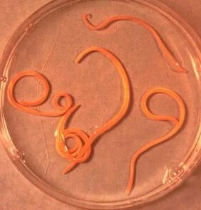Parasites of the man Ascarid