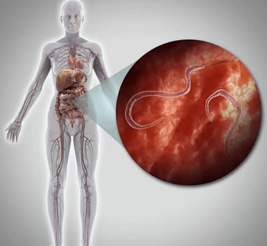 Parasites in the human body