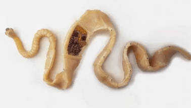 How to discover the presence of parasites in the body