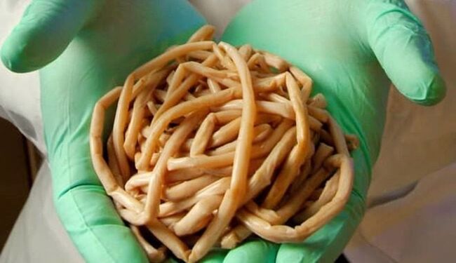Removal of parasites from the body